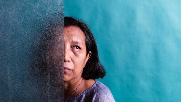 Middle-aged woman looking concerned while partially hidden behind a wall, symbolising uncertainty about hormonal treatment and dementia risk.