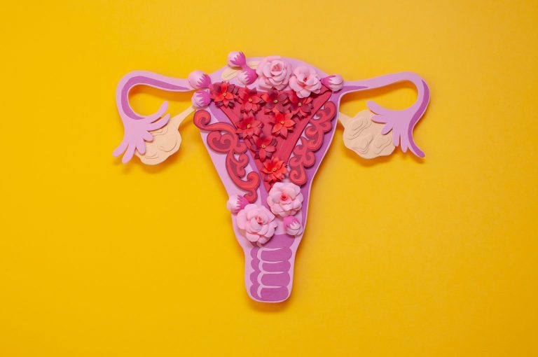 What Is Endometriosis?