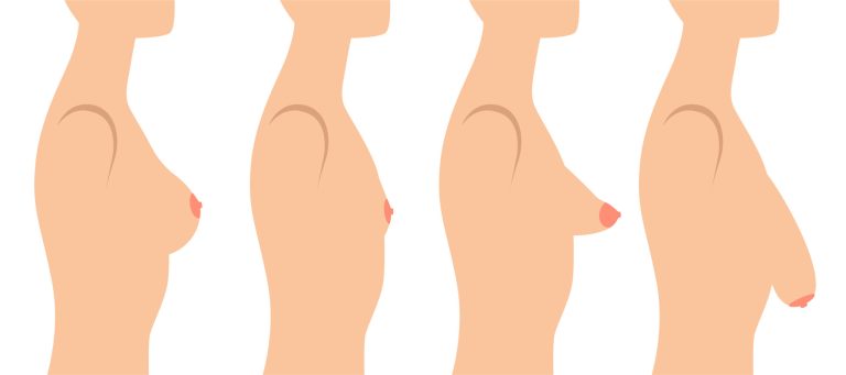 Breast Health: What’s Normal?